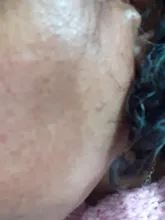 Crema facial antimanchas para hombres y mujeres, crema hidratante para la piel, reafirmante, elimina pecas y acné, pigmento, melanina