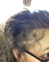 Suero para el crecimiento del cabello de jengibre, tratamiento para la pérdida del cabello con Spray, aceite esencial para el crecimiento del cabello Germinal efectivo en 7 días, cuidado del cabello para hombres y mujeres, 30ml