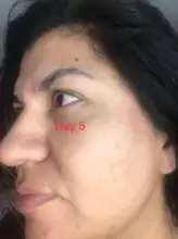 Suero facial con ampolla de vitamina C, blanqueador, antiarrugas, hidratante, reduce los poros, repara el cuidado de la piel facial