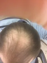 OMY LADY-aceite esencial para hombres y mujeres, Spray para el crecimiento del cabello, líquido para la pérdida de cabello seco, reparador, producto para la pérdida de cabello