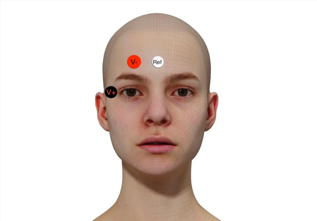 EMG || ECG || EOG Sensor (All in One BioSensor for Muscle, Eye and Heart Signals,Arduino Nano Shield ) -MaM Sense- EMG || ECG || EOG Sensor (All in One BioSensor for Muscle, Eye and Heart Signals,Arduino Nano Shield ) -MaM Sense-