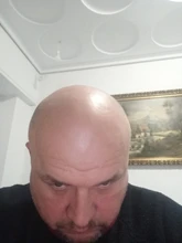 PURC-pulverizador para el crecimiento del cabello, tratamiento para la pérdida de cabello, para adelgazar, cuidado del cabello, 30ml