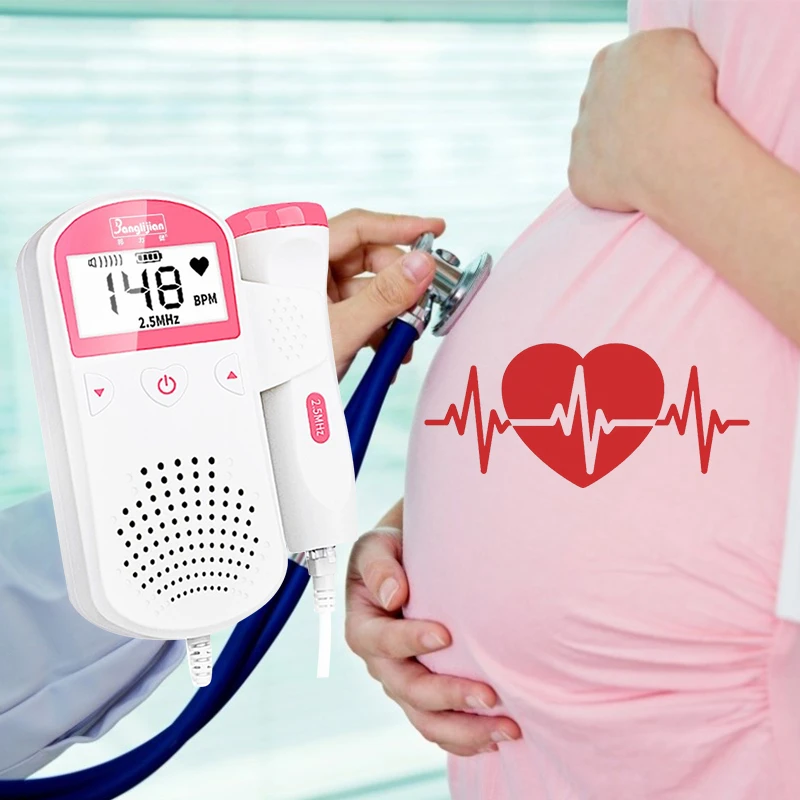 doppler ultrasound fetal heart rate