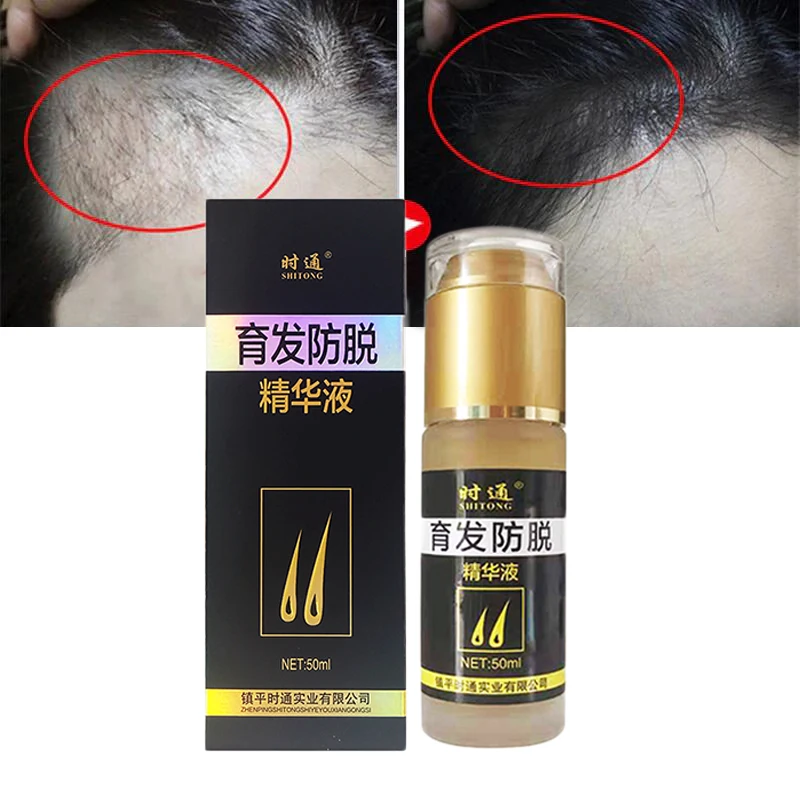 

Ginger Hair Growth Essential Oil Serum Anti Hair Loss Products Fast Grow Prevent Hair Thinning Dry Frizzy Damaged Hair Care