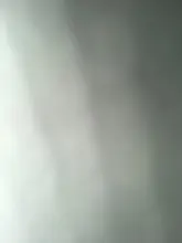 E***a