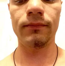 A***n