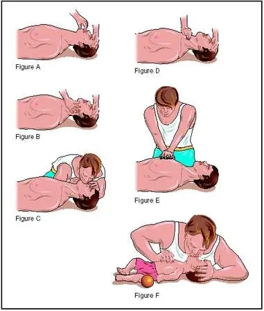 cpr KITG