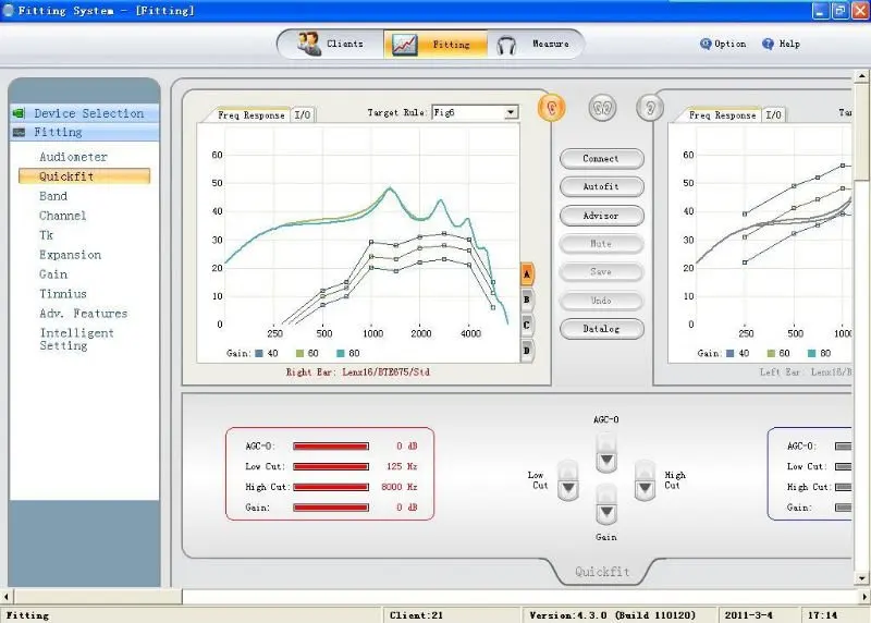 Fitting System programmable s.JPG