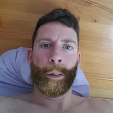 A***a