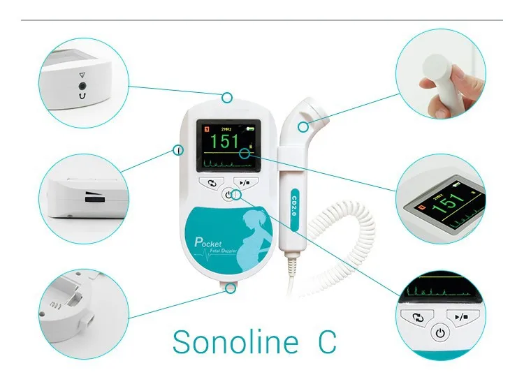 sonoline b fetal doppler target