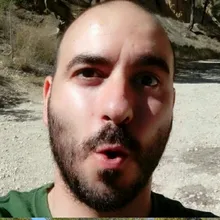 E***M