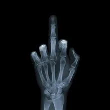 B***v