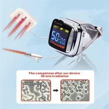 Оздоравливающий продукт 650nm наручные Стиль гипертонии устройство лазерной терапии