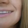 A***e
