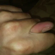 I***S