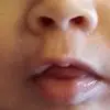 K***p