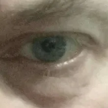 A***c