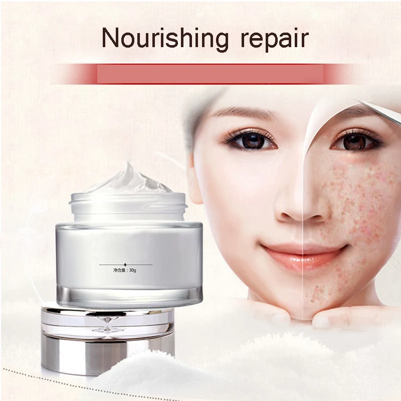 Buy Freckles Cream Dark Spot Fade Face Cream Skin