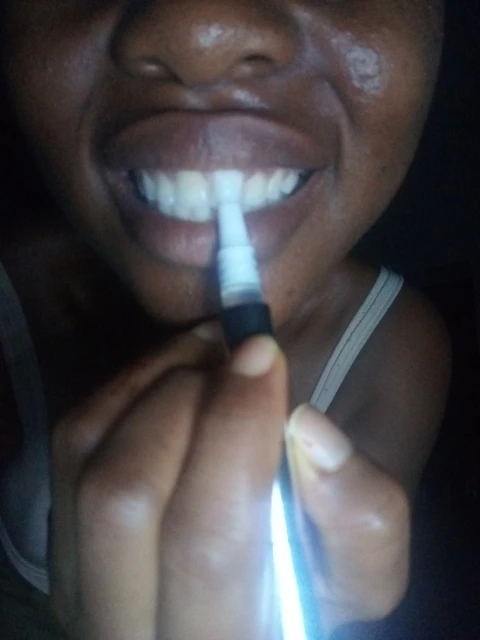 Teeth Whitening Pen For Brighter Smile photo review