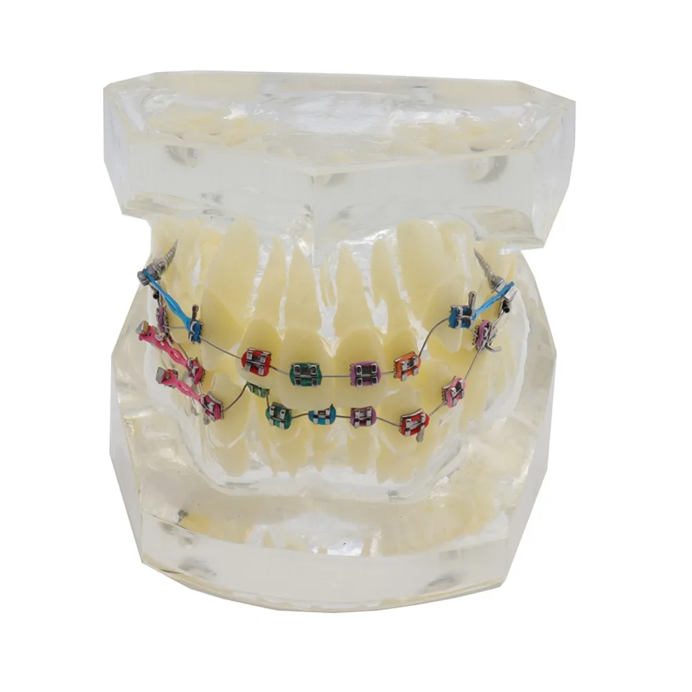 

Dental Standard Orthodontics Teeth Model With Brackets & Buccal Tubes Malocclusion Corret Teeth Model Elastolink Chain Teeth