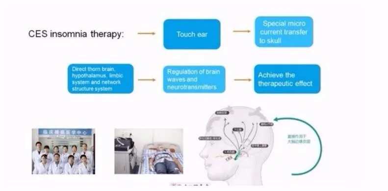 ATANG новая терапия CES транскраниальный стимулятор микро-тока устройство для лечения сна бессонница тревога боль в голове