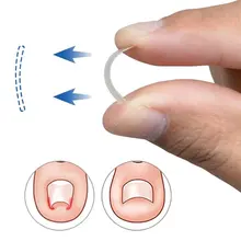 Лидер продаж 10 шт./кор. вросших ногтей коррекция носок Стикеры патч коррекция паронихии файл акроникс проволочный корректор Уход за ногами