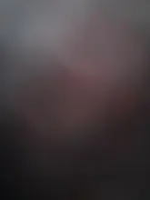 E***a