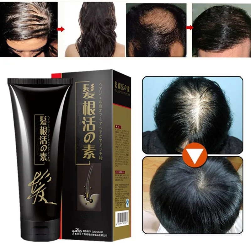 

250ml Hair Growth Treatment Shampoo Hair Loss Scrip Growth Oil Natural Herb Effective Essence Thinning Breakage Hair Regrow