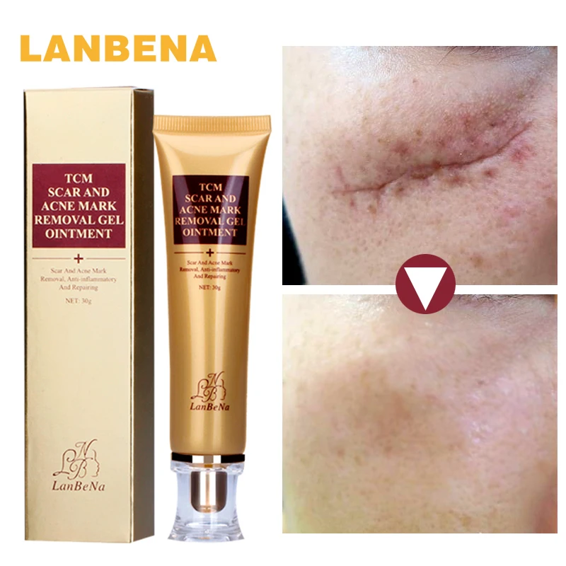 

LANBENA Remove Acne Scars Repair Gel Red Spots Face Cream Moisturizing Skin Care Remove Blackhead Whitening Cream Stretch Marks