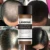 LANBENA Hair Faster Growth Essence Hair Growth Beauty Essential Oil Liquid Treatment Preventing Hair Loss Hair Care Andrea 20ml Peshawar