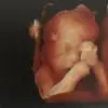 S***e