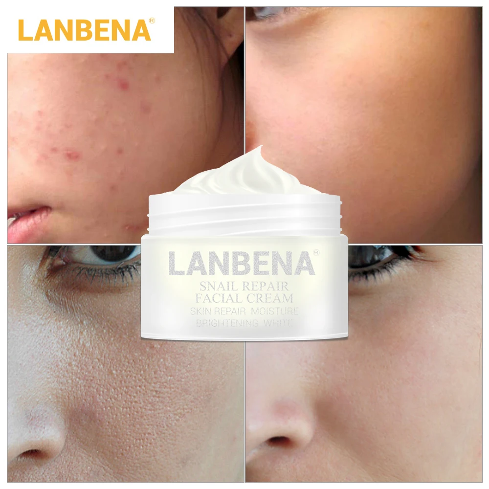 

Skin Care Snail Repair Face Cream Improve Acne Skin Whitening Snail Moisturizing Anti Wrinkle Anti Aging Face Cream By LANBENA