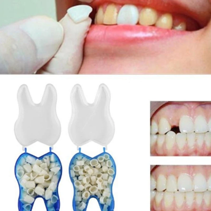 

55Pcs/Box Ultra Thin Dental Crowns Resin Porcelain Veneers Teeth Oral Care Teeth Whitening Anterior Molar Temporary Crown