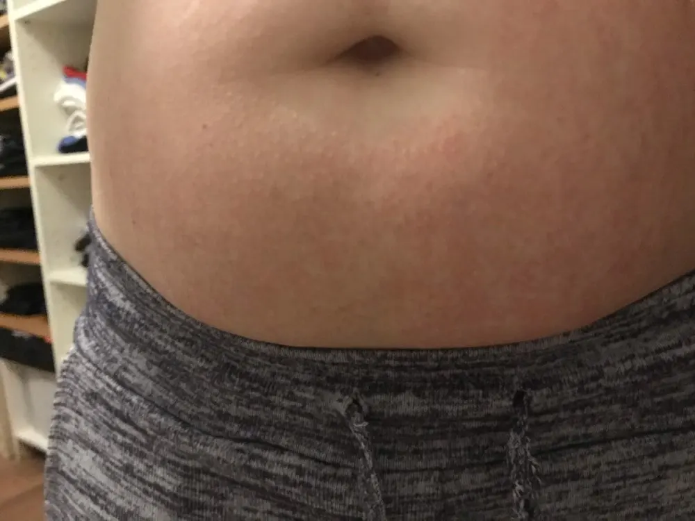 Fat Burning Belly Patch For Slimming photo review