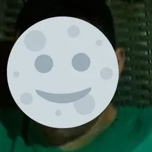 E***a