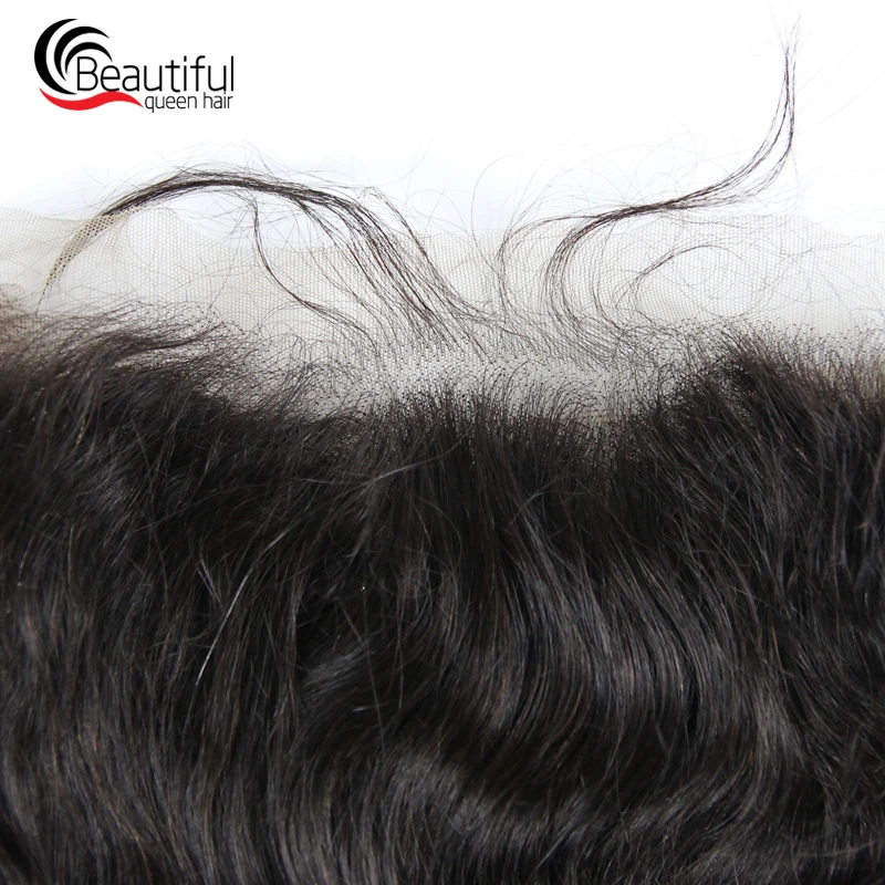frontal