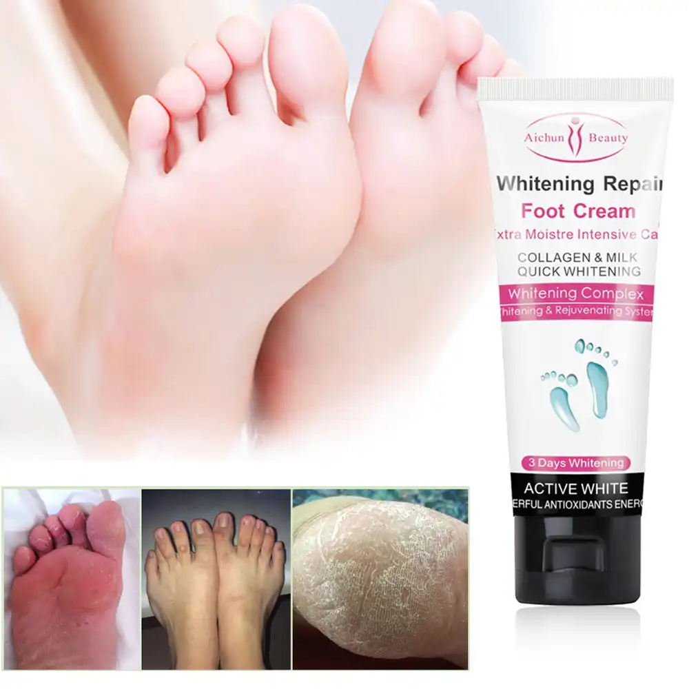 foot ointment dry skin