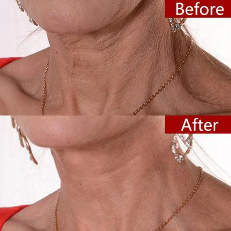 Reusable-Silicone-Care-Neck-Pad-Neck-Tape-Wrinkle-Pads-for-Neck-Wrinkle-Treatment-Prevention-Anti-Wrinkle.webp