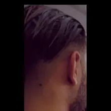 T***L