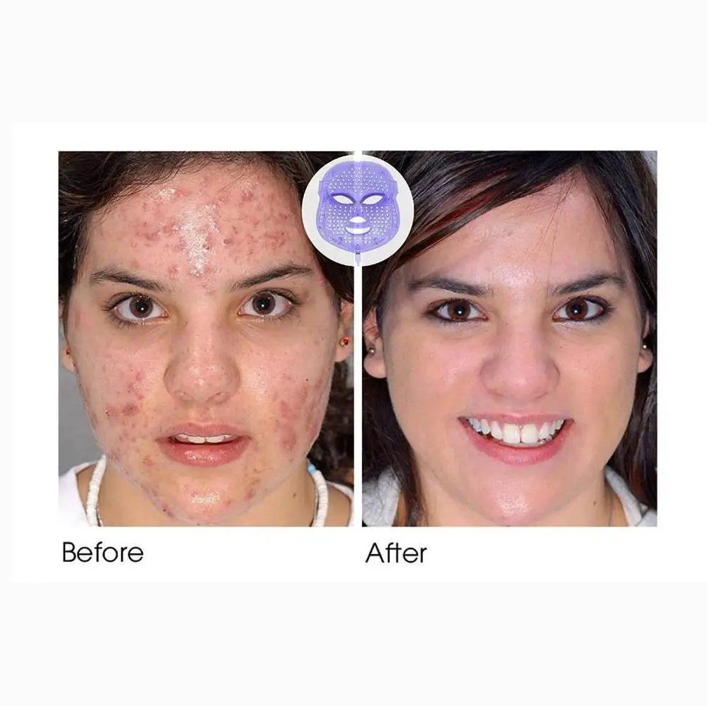inspire-uplift-spa-mask-led-spa-facial-mask-1411868524555_1000x