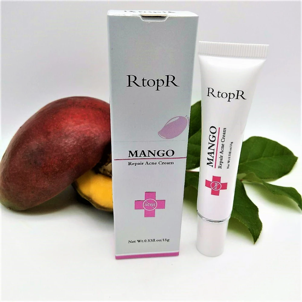 mango acne cream