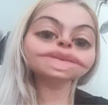 M***a