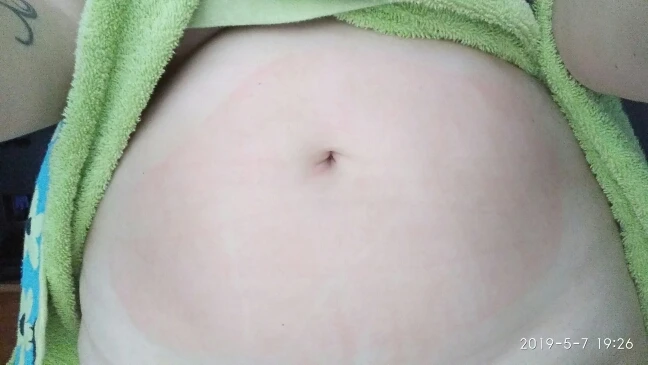Fat Burning Belly Patch For Slimming photo review