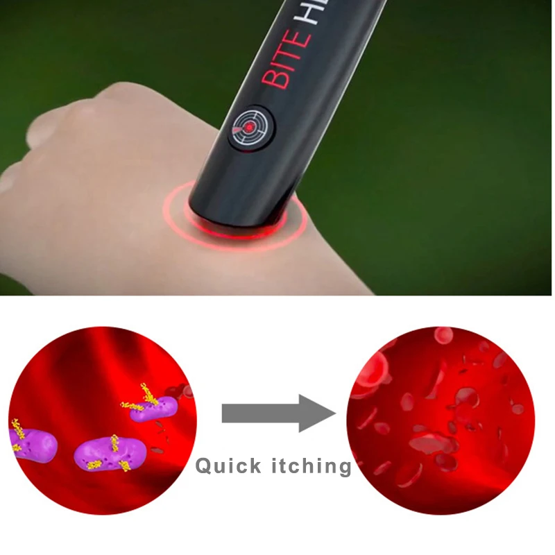 Creative Relieve Itch Device Mosquito Pest Bug Bite Helper Anti-itch Pen Insect Sting Itch Neutralizing Reliever For Child Adult Creative Relieve Itch Device Mosquito Pest Bug Bite Helper Anti-itch Pen Insect Sting Itch Neutralizing Reliever For Child Adult