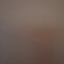 E***a