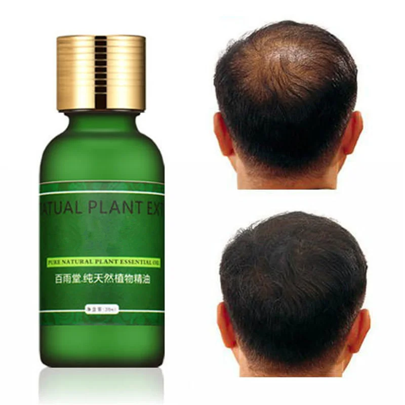 Hair Care Hair Growth Essential Oil Authentic Herbs 100 Hair Loss