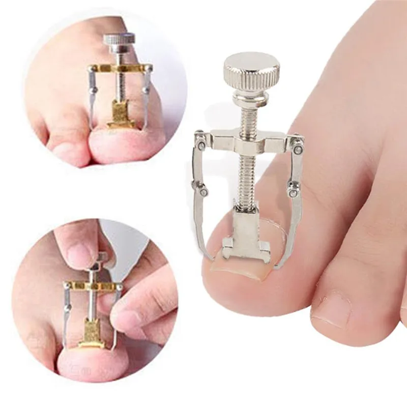

1Pc Ingrown Nail Tool Ingrown Toenails Pedicure Foot Nail Care Tools File For Feet Orthotic Acronyx Ingrowing Nail Onyxis Bunion