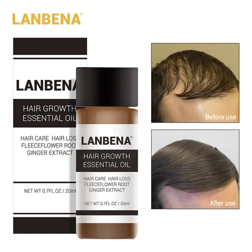 LANBENA Hair Faster Growth Essence Hair Growth Beauty Essential Oil Liquid Treatment Preventing Hair Loss Hair Care Andrea 20ml Lahore