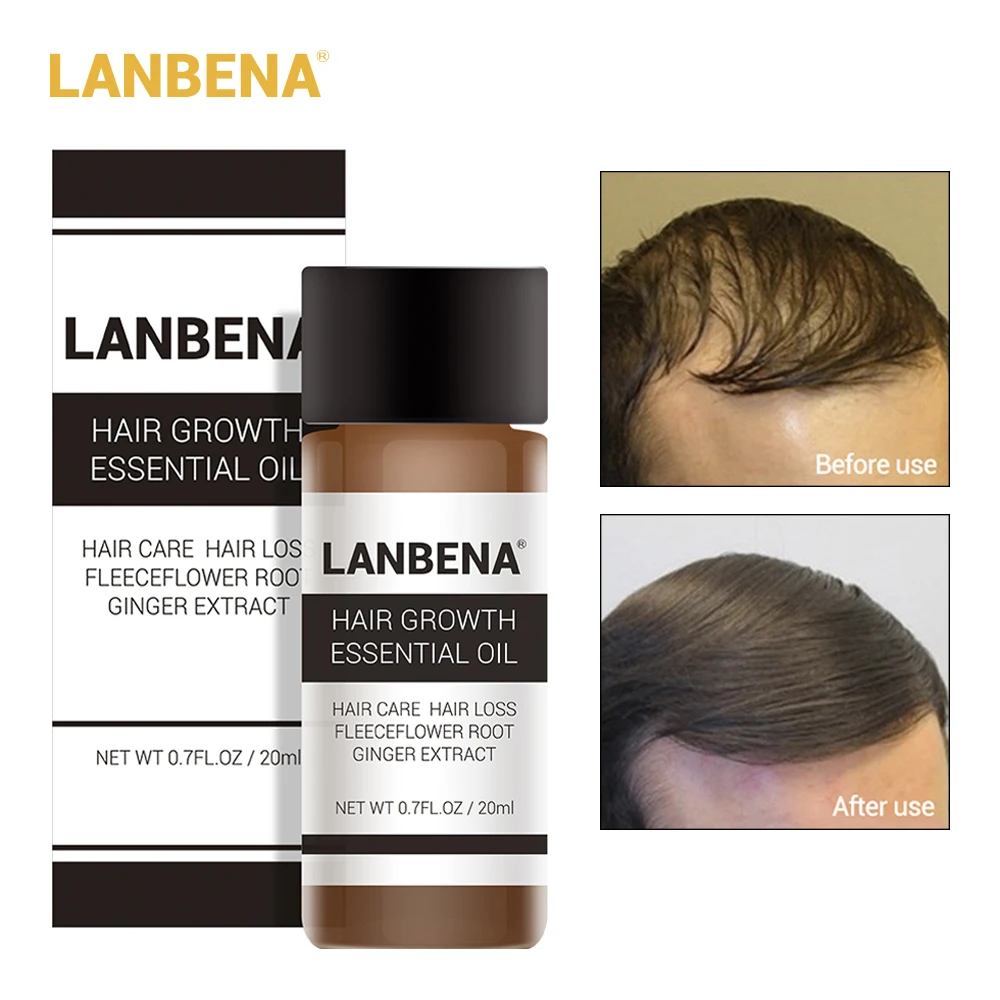 LANBENA الشعر أسرع نمو جوهر نمو الشعر الجمال زيت طبيعي السائل العلاج منع فقدان الشعر العناية بالشعر أندريا 20 مللي