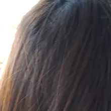l***n